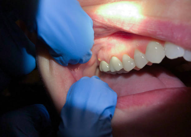 Best Urgent Dental Care for Toothaches in Prien, LA